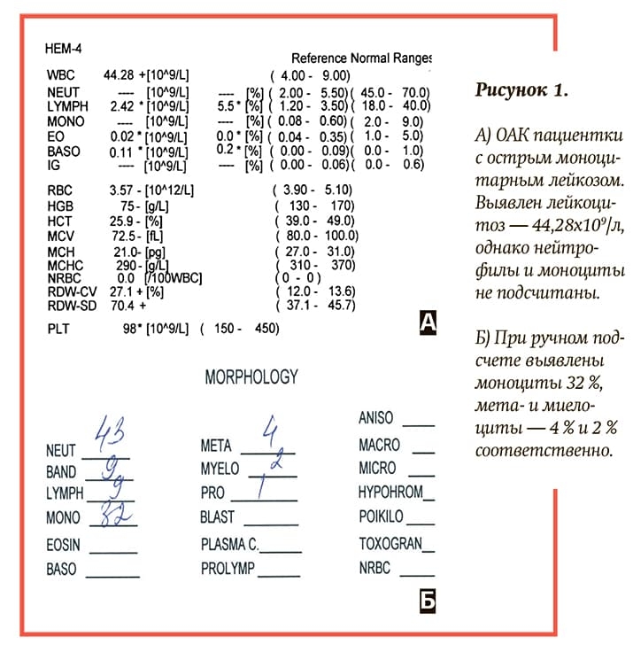 Risunok1 A B