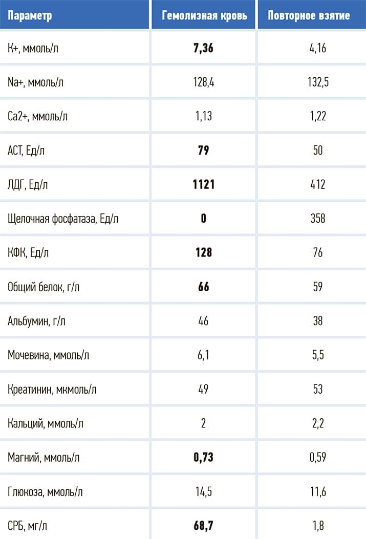 Sravnenie rezultata analiza tabl1