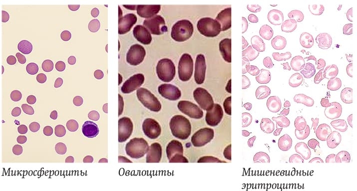 Morfologiya eritrocitov