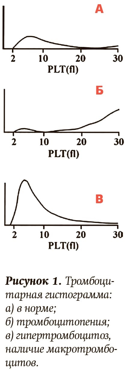 Risunok 1. Trombocitarnaya gistogramma