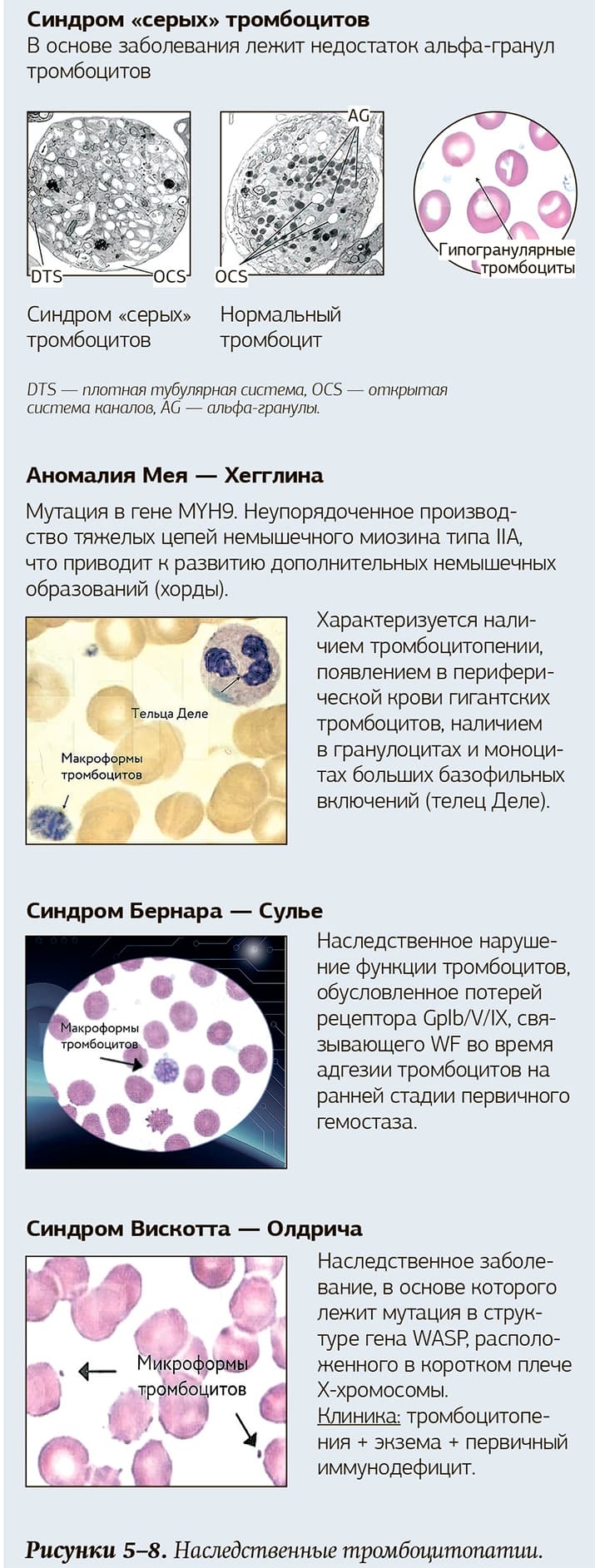 Risunok 5 8. Trombocitopatii