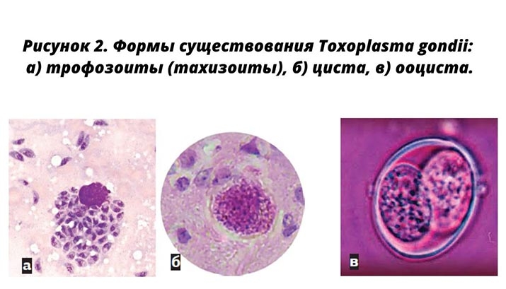 toksoplazmoz 2 ris 01.09.jpg