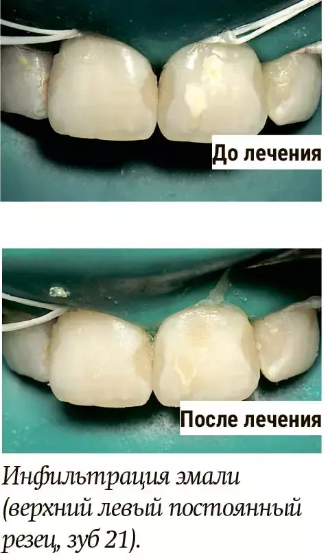 vzvv98z9