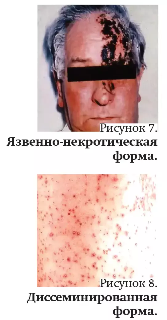 xddx44x