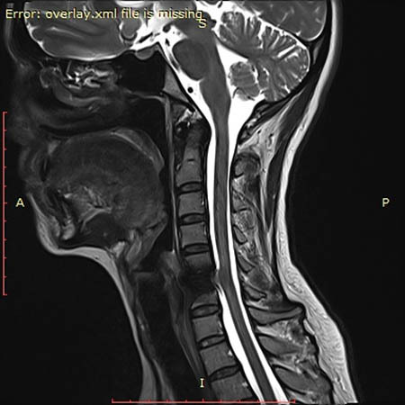 mify osteohondroz 13.04 ris 4
