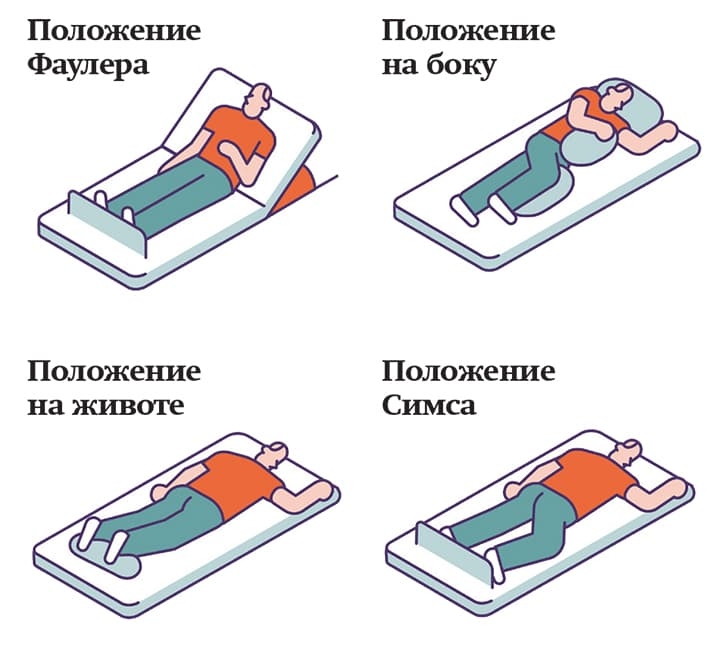 AKTIVACIYa PACIENTA V POSTELI