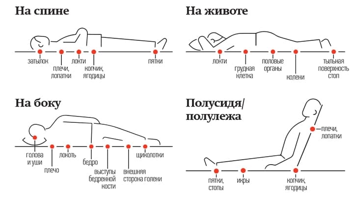 Mesta lokalizacii prolezhnej