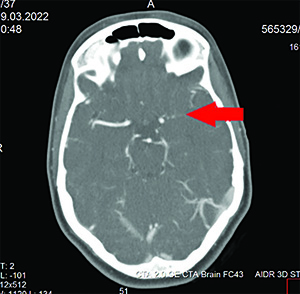 hvcf45s