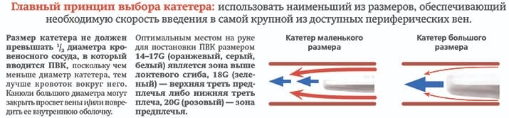 perifericheskij venoznyj kateter rabota