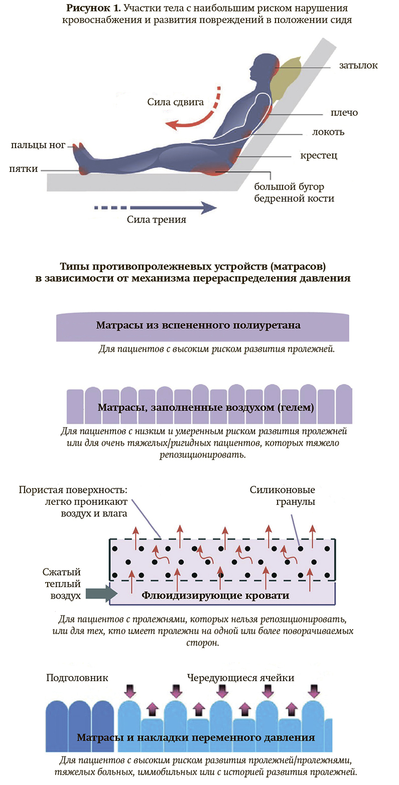 пролежни рисунок